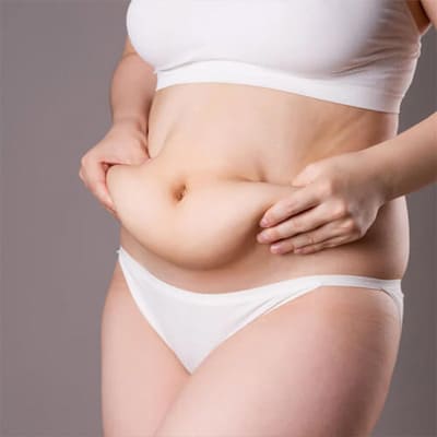Tummy Tuck(Abdominoplasty)
