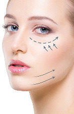 Fraksiyonel CO2 Lazer