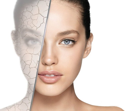 Cilt Çatlağı Tedavisi